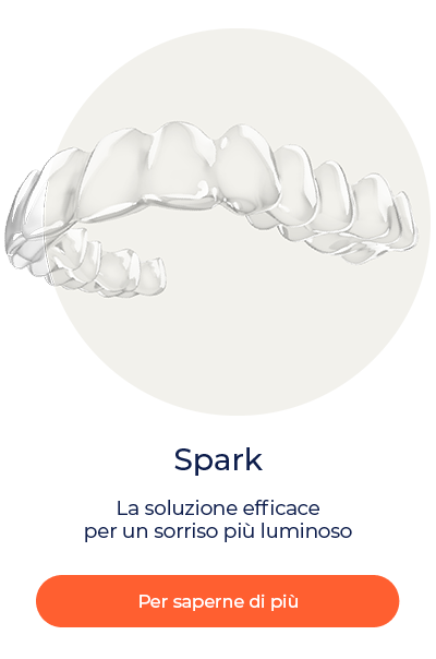 012 Product-spark IT
