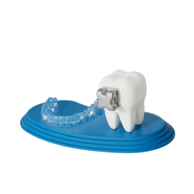 Ormco-Forum-2027_Aligner-and-brackets-1-280x280 Ormco-Forum-2027_Aligner-and-brackets-1-280x280